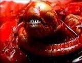 Ein Chestburster